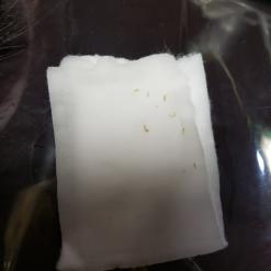 구미 피부관리 봉곡동 피부관리실 트러블 압출 제대로 관리하는 마실뷰티
