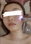 광교 피부관리 올가뷰티 광교점에서 했어요!(MTS 플라즈마 관리)