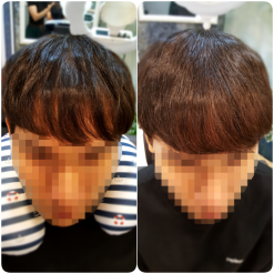 강북구탈모/노원구탈모/동대문구탈모/의정부탈모/남대문탈모/중에 탈모치료 탈모케어 헤어증모 잘하는곳 추천해드려요