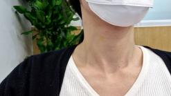 청담동 피부과 목주름 관리 디어넥주사 플러스