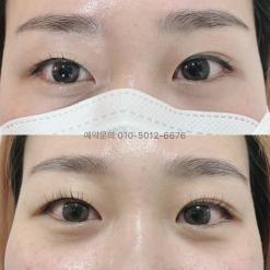 대구 속눈썹펌으로 인한 손상모, 복구펌 가능한 곳 진천동 그언니샵!!