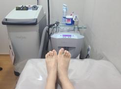 잠실제모 종아리 아포지플러스 후기