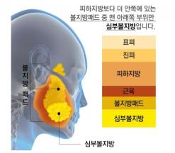 광주 피부관리 화정동피부관리-리프팅관리-