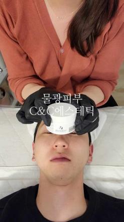 김포 피부샵:저자극 필링